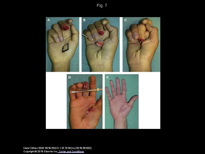 Fig. 7 Hand Clinics 2020 3619 -32 DOI: (10. 1016/j. hcl. 2019. 08. 003)