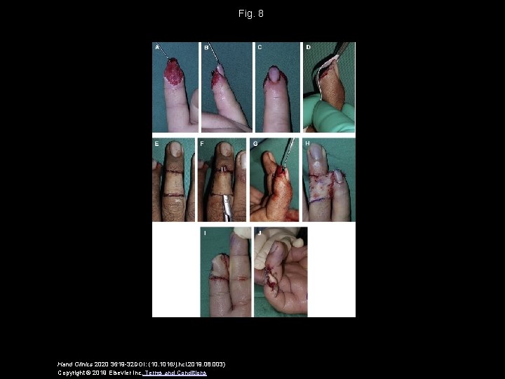 Fig. 8 Hand Clinics 2020 3619 -32 DOI: (10. 1016/j. hcl. 2019. 08. 003)