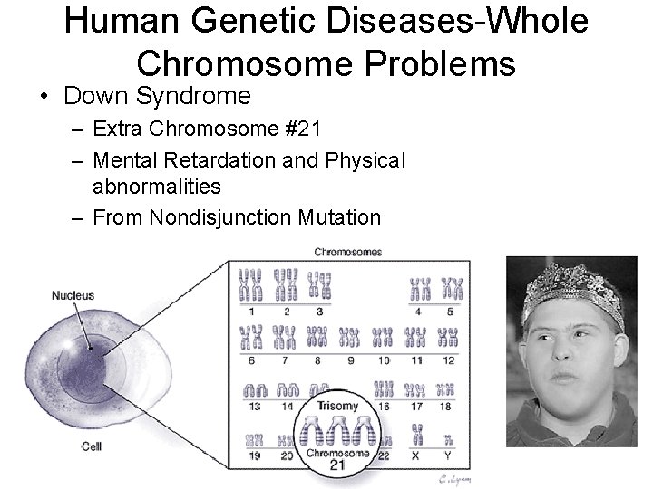 Human Genetic Diseases-Whole Chromosome Problems • Down Syndrome – Extra Chromosome #21 – Mental