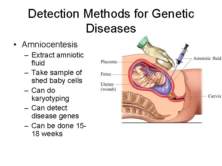 Detection Methods for Genetic Diseases • Amniocentesis – Extract amniotic fluid – Take sample