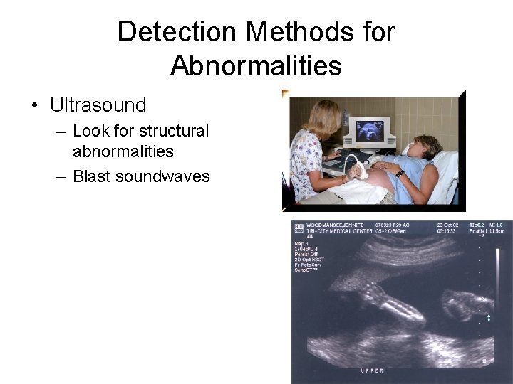 Detection Methods for Abnormalities • Ultrasound – Look for structural abnormalities – Blast soundwaves