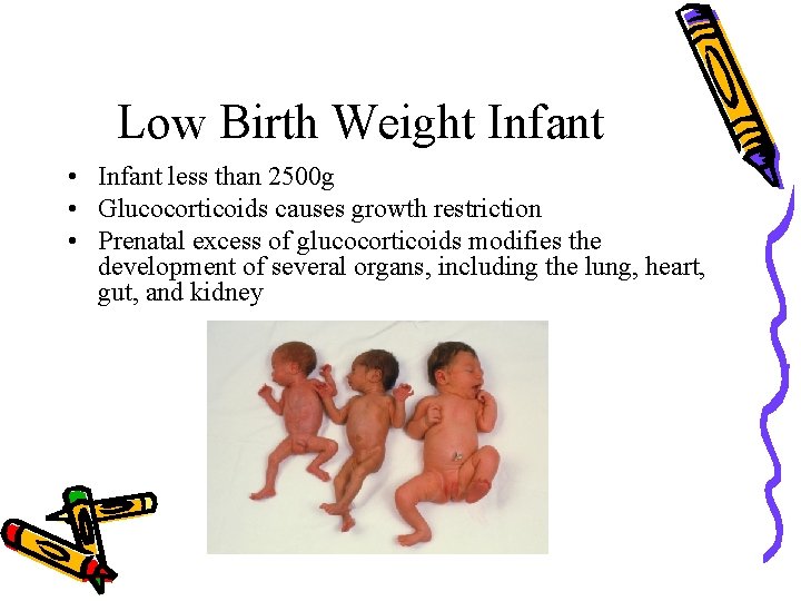 Low Birth Weight Infant • Infant less than 2500 g • Glucocorticoids causes growth