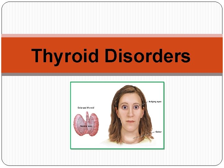 Thyroid Disorders 