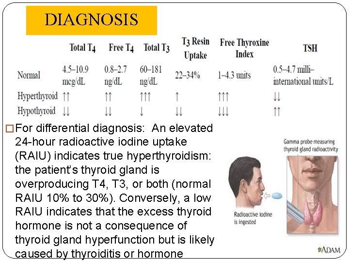 DIAGNOSIS � For differential diagnosis: An elevated 24 -hour radioactive iodine uptake (RAIU) indicates