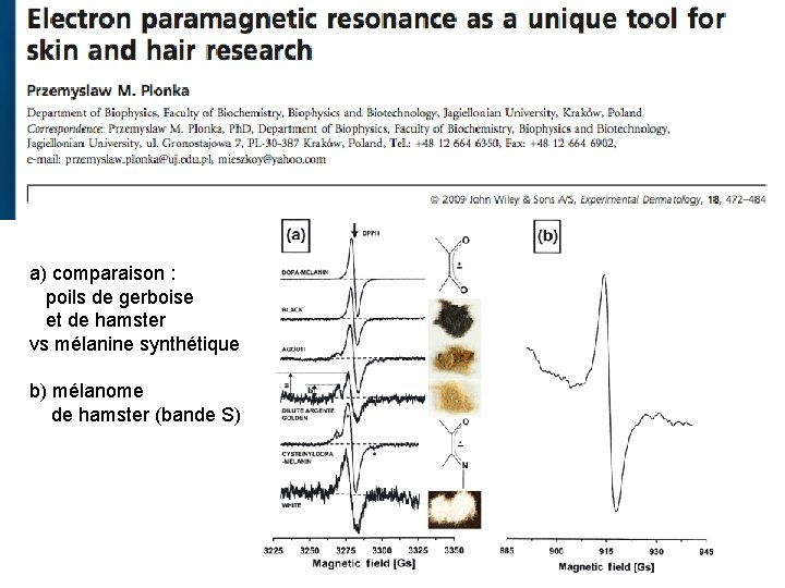 a) comparaison : poils de gerboise et de hamster vs mélanine synthétique b) mélanome a) comparaison : poils de gerboise et de hamster vs mélanine synthétique b) mélanome