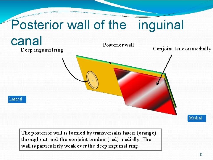 Posterior wall of the inguinal canal Deep inguinal ring Posterior wall Conjoint tendon medially