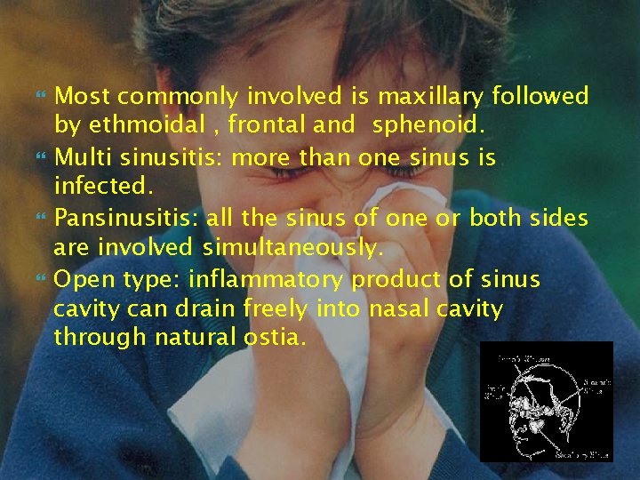  Most commonly involved is maxillary followed by ethmoidal , frontal and sphenoid. Multi