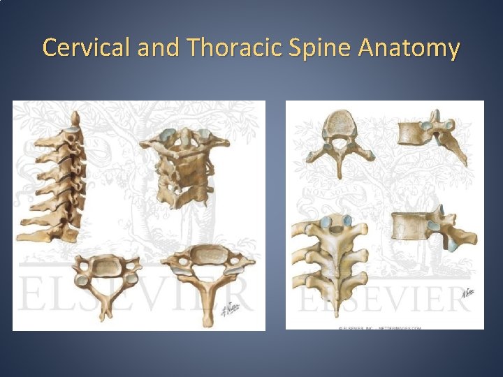 Cervical and Thoracic Spine Anatomy Cervical and Thoracic Spine Anatomy