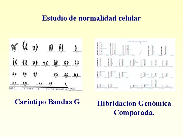 Estudio de normalidad celular Cariotipo Bandas G Hibridación Genómica Comparada. 