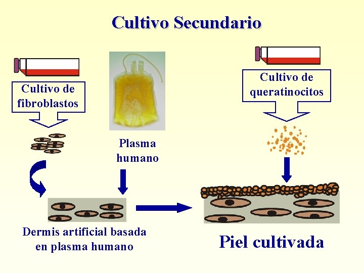 Cultivo Secundario Cultivo de queratinocitos Cultivo de fibroblastos Plasma humano Dermis artificial basada en