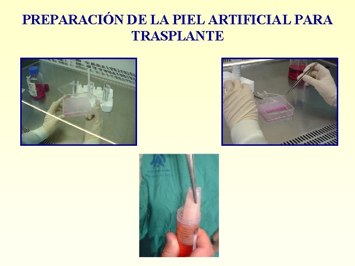 PREPARACIÓN DE LA PIEL ARTIFICIAL PARA TRASPLANTE 