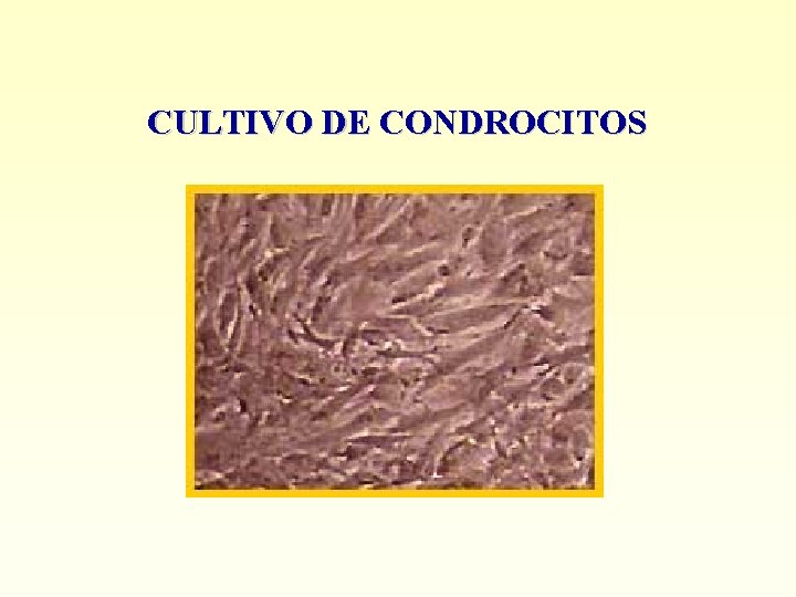 CULTIVO DE CONDROCITOS 