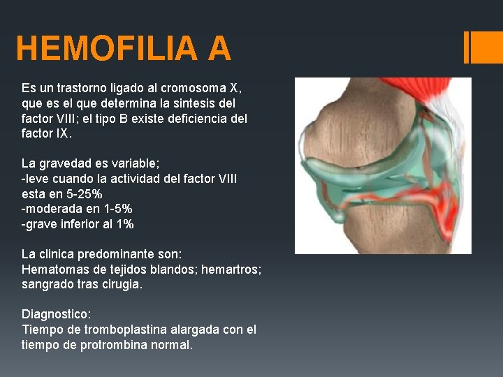 HEMOFILIA A Es un trastorno ligado al cromosoma X, que es el que determina