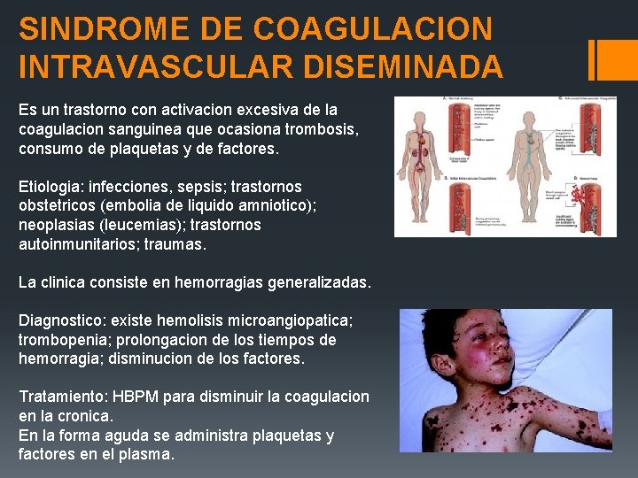 SINDROME DE COAGULACION INTRAVASCULAR DISEMINADA Es un trastorno con activacion excesiva de la coagulacion