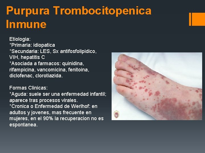 Purpura Trombocitopenica Inmune Etiologia: *Primaria: idiopatica *Secundaria: LES, Sx antifosfolipidico, VIH, hepatitis C *Asociada