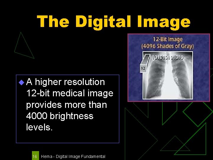 The Digital Image u. A higher resolution 12 -bit medical image provides more than