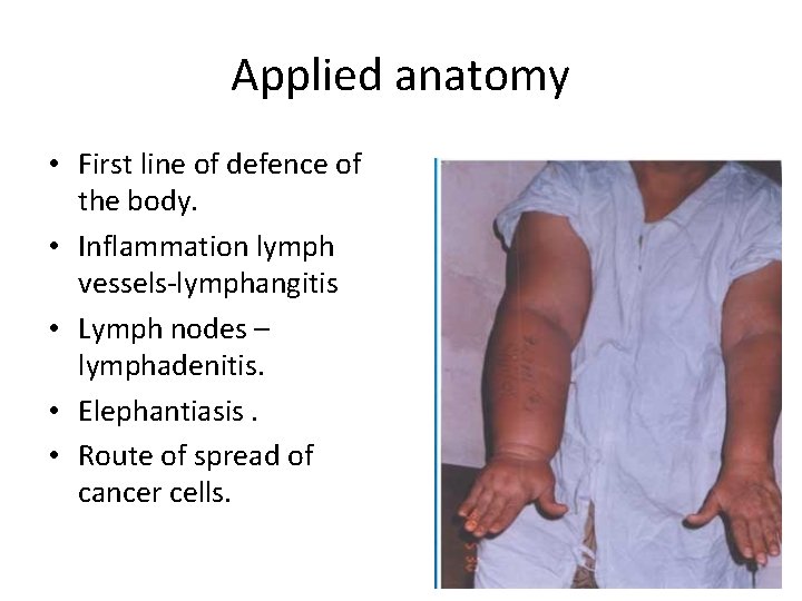 Applied anatomy • First line of defence of the body. • Inflammation lymph vessels-lymphangitis