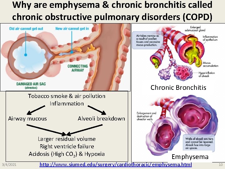 Why are emphysema & chronic bronchitis called chronic obstructive pulmonary disorders (COPD) Chronic Bronchitis Why are emphysema & chronic bronchitis called chronic obstructive pulmonary disorders (COPD) Chronic Bronchitis