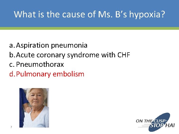 What is the cause of Ms. B’s hypoxia? a. Aspiration pneumonia b. Acute coronary