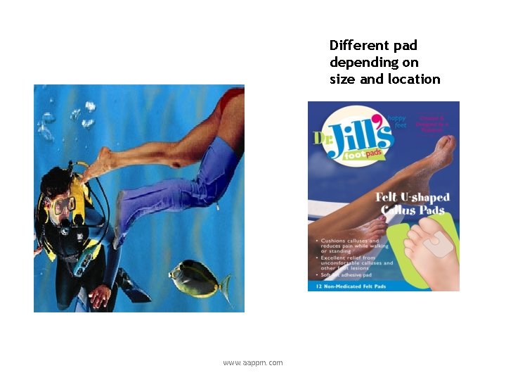 Different pad depending on size and location www. aappm. com 