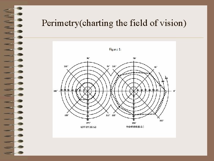 Perimetry(charting the field of vision) 