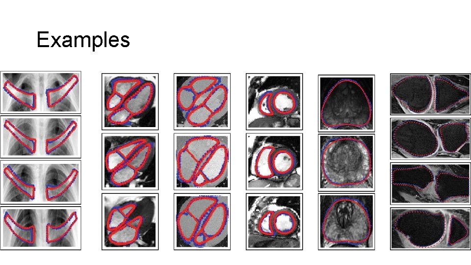 Multitask Shape Regression for Medical Image Segmentation Xiantong