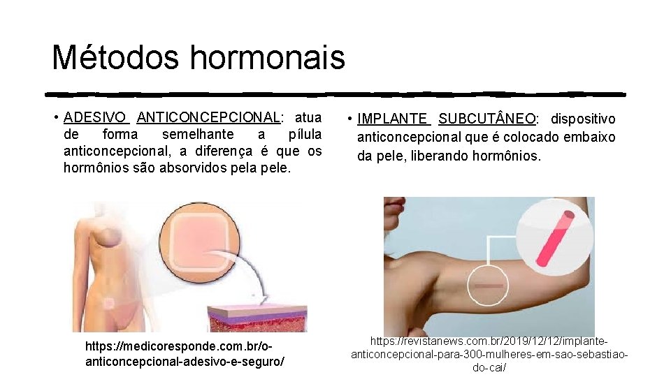 Métodos hormonais • ADESIVO ANTICONCEPCIONAL: atua de forma semelhante a pílula anticoncepcional, a diferença Métodos hormonais • ADESIVO ANTICONCEPCIONAL: atua de forma semelhante a pílula anticoncepcional, a diferença