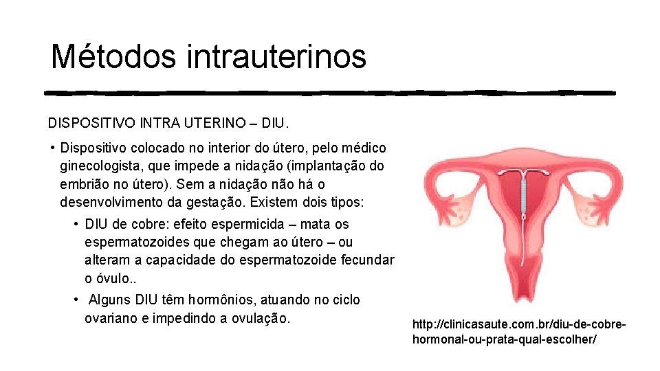 Métodos intrauterinos DISPOSITIVO INTRA UTERINO – DIU. • Dispositivo colocado no interior do útero, Métodos intrauterinos DISPOSITIVO INTRA UTERINO – DIU. • Dispositivo colocado no interior do útero,
