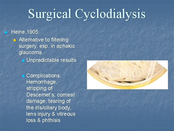 Surgical Cyclodialysis n Heine, 1905: n Alternative to filtering surgery, esp. in aphakic glaucoma