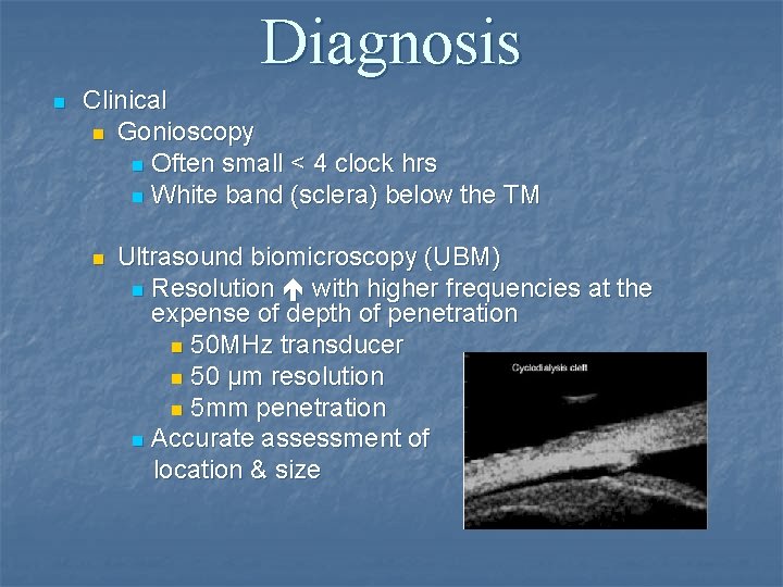 Diagnosis n Clinical n Gonioscopy n Often small < 4 clock hrs n White