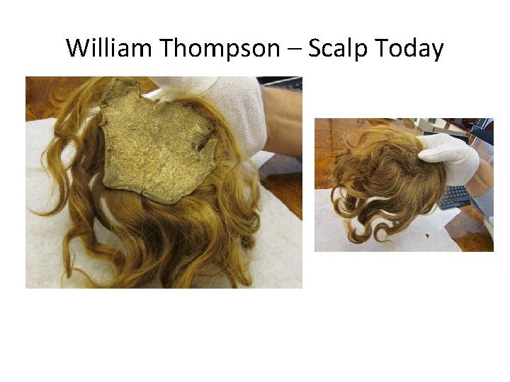 William Thompson – Scalp Today 