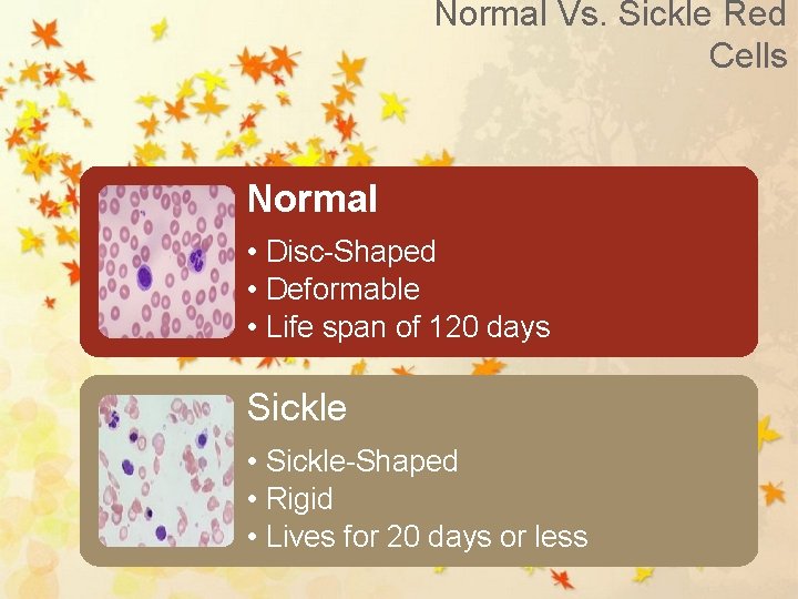 Normal Vs. Sickle Red Cells Normal • Disc-Shaped • Deformable • Life span of