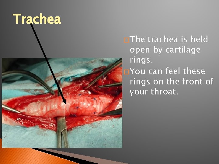 Trachea � The trachea is held open by cartilage rings. � You can feel