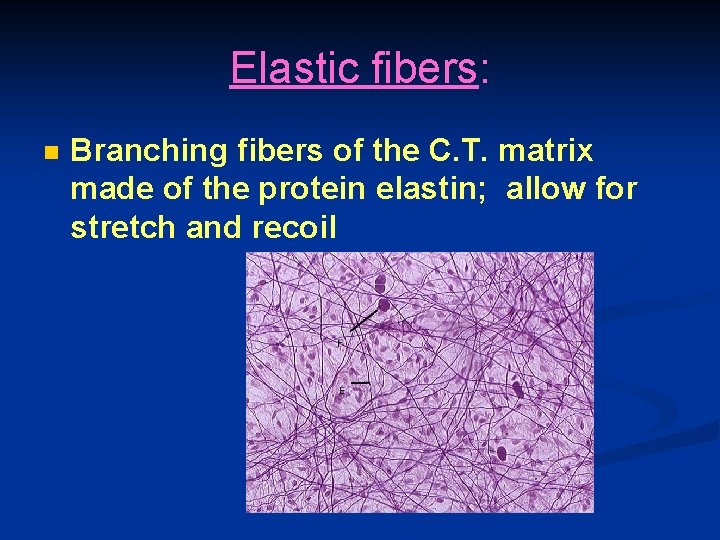 Elastic fibers: n Branching fibers of the C. T. matrix made of the protein