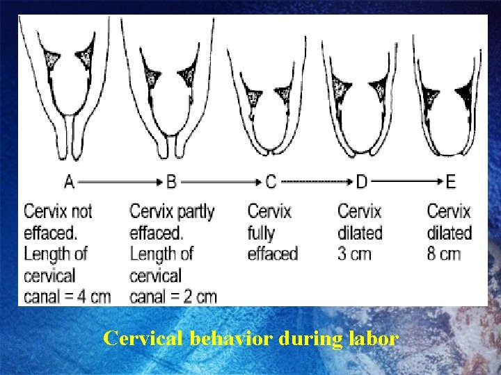Cervical behavior during labor 