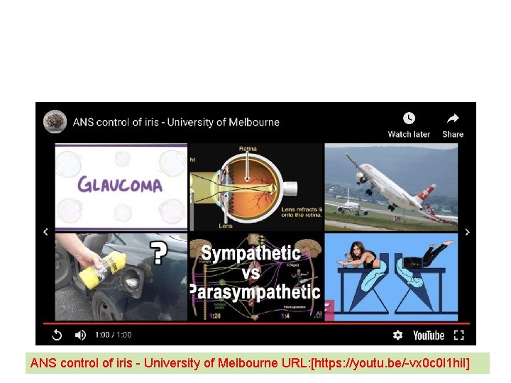 ANS control of iris - University of Melbourne URL: [https: //youtu. be/-vx 0 c