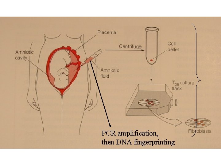 PCR amplification, then DNA fingerprinting 