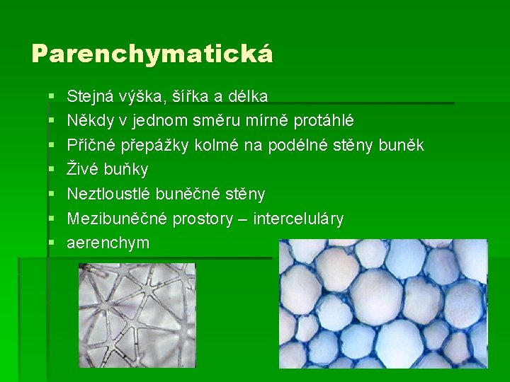 Parenchymatická § § § § Stejná výška, šířka a délka Někdy v jednom směru