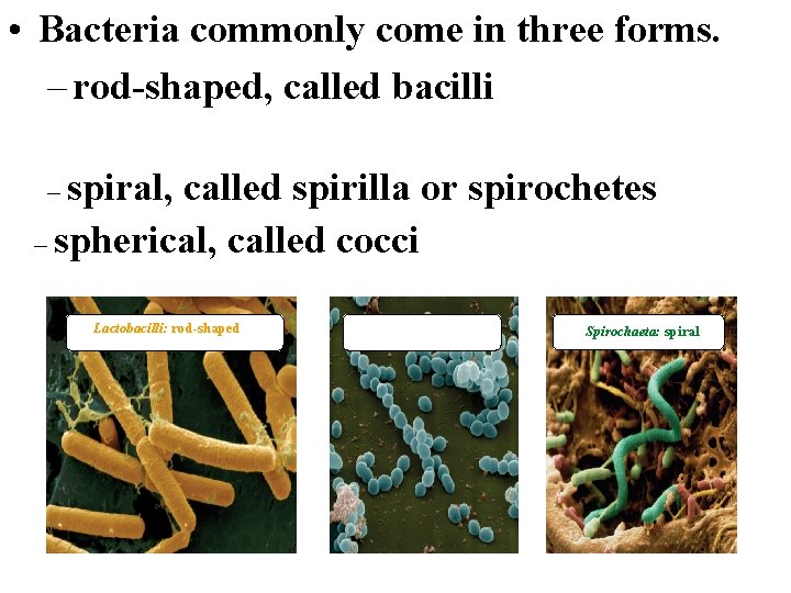  • Bacteria commonly come in three forms. – rod-shaped, called bacilli – spiral,