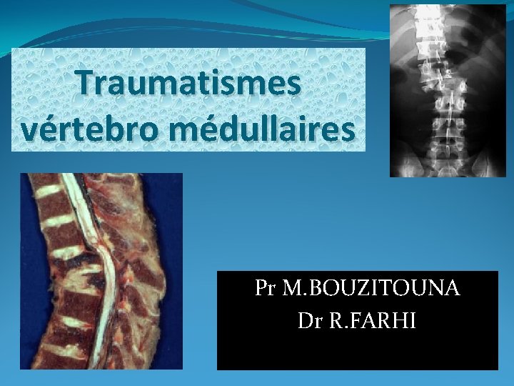 Traumatismes vértebro médullaires Pr M. BOUZITOUNA Dr R. FARHI 