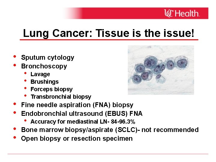 Lung Cancer: Tissue is the issue! • • • Sputum cytology Bronchoscopy • •