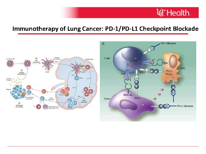 Immunotherapy of Lung Cancer: PD-1/PD-L 1 Checkpoint Blockade 