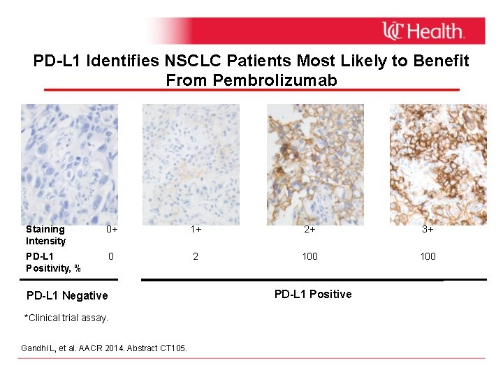 PD-L 1 Identifies NSCLC Patients Most Likely to Benefit From Pembrolizumab Staining Intensity 0+