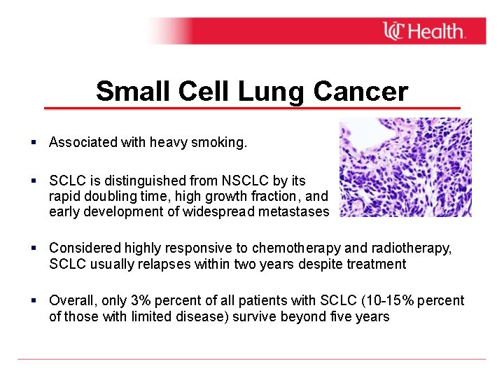 Small Cell Lung Cancer Associated with heavy smoking. SCLC is distinguished from NSCLC by