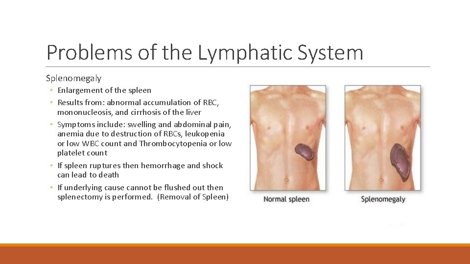 Problems of the Lymphatic System Splenomegaly ◦ Enlargement of the spleen ◦ Results from: