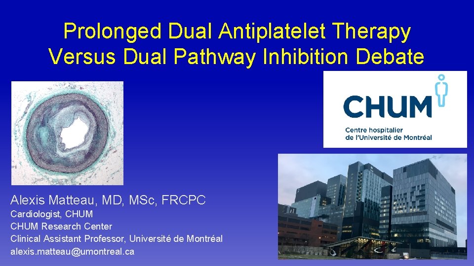 Prolonged Dual Antiplatelet Therapy Versus Dual Pathway Inhibition Debate Alexis Matteau, MD, MSc, FRCPC