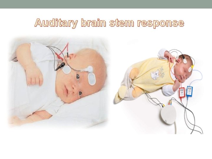 Auditary brain stem response 
