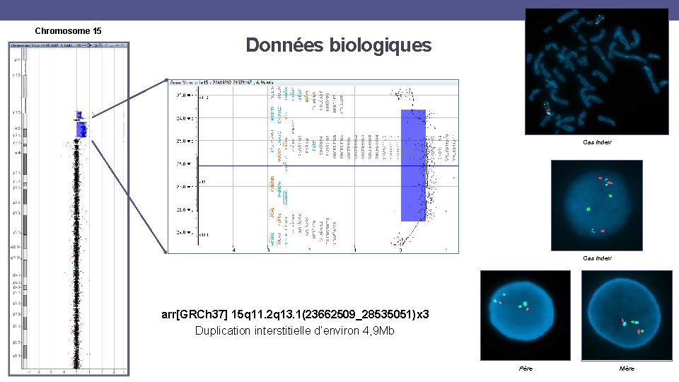 Chromosome 15 Données biologiques Cas index arr[GRCh 37] 15 q 11. 2 q 13.