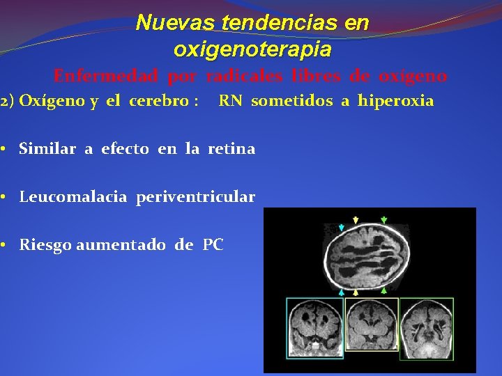 Nuevas tendencias en oxigenoterapia Enfermedad por radicales libres de oxígeno 2) Oxígeno y el