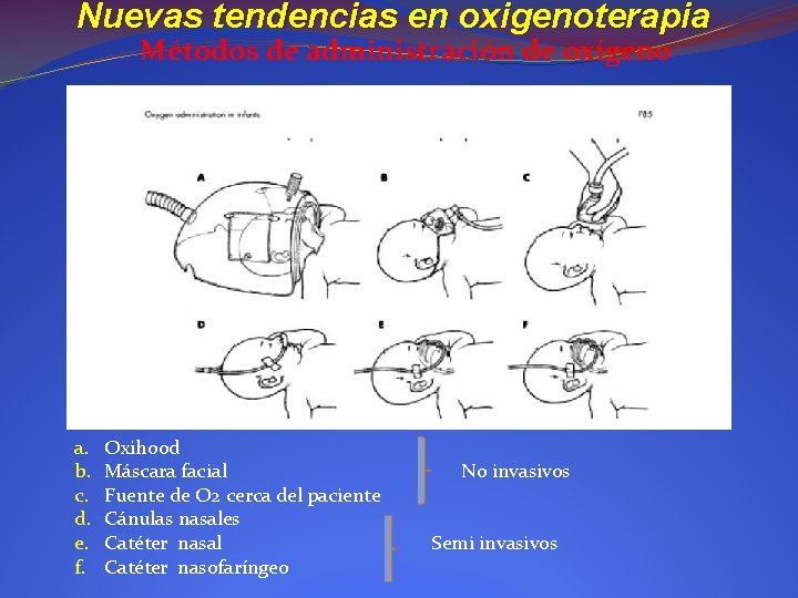 Nuevas tendencias en oxigenoterapia Métodos de administración de oxígeno a. b. c. d. e.